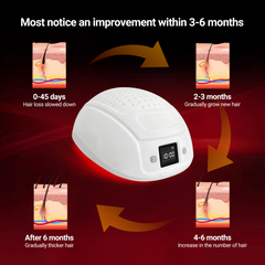 Laser Red Light Therapy for Hair Growth - FDA Cleared Hair Loss, Hair Thinning & Alopecia Treatment for Men & Women - Stimulate Denser Fuller Hair